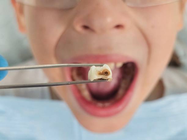 Best Emergency Dentist No Insurance  in Coral Terrace, FL