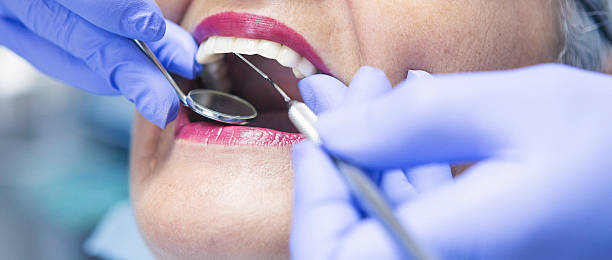 Best Dentist for Tooth Abscess  in Coral Terrace, FL