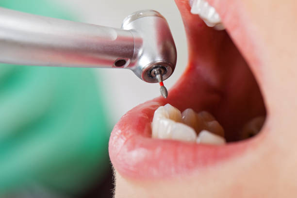 Best Emergency Tooth Extraction  in Coral Terrace, FL